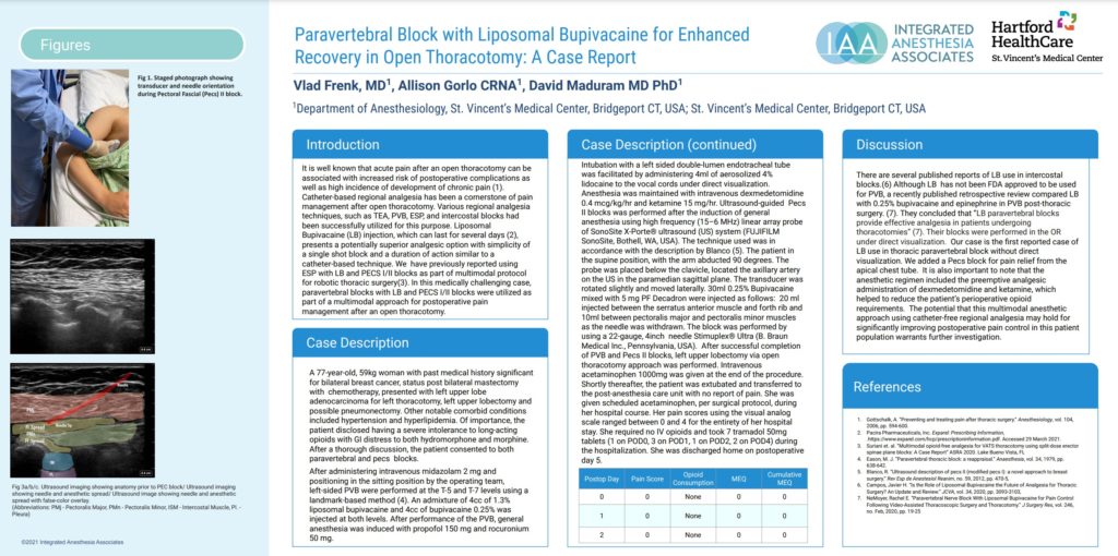 Paravertebral Block with Liposomal Bupivacaine in Thoracotomy...