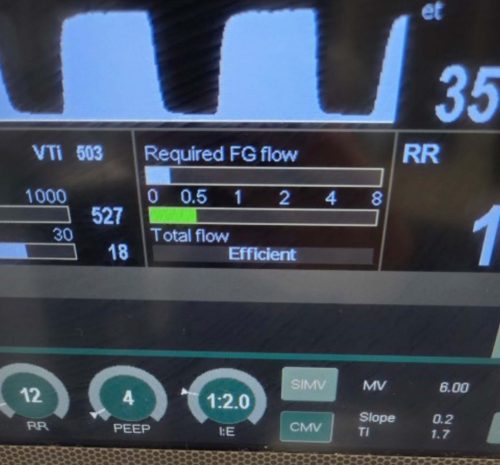 New Anesthesia Machines
